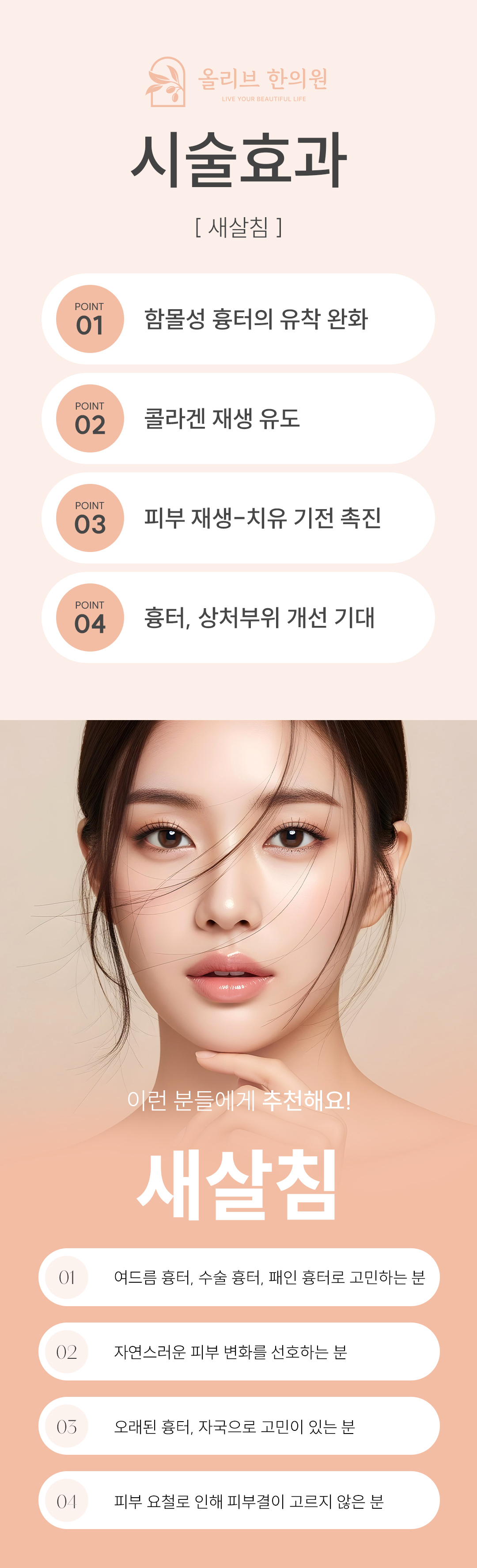 새살침이란
여드름 흉터(특히 패인 흉터, rolling/boxcar type), 오래된 흉터,  수술 흉터 등 조직이 아래로 당겨진 함몰 부위 등을 밑에서 끊어 올려주는 시술을 말합니다.

작용 원리
흉터 바닥을 아래로 잡아당겨서 패임, 함몰을 일으키는 섬유성 밴드(fibrotic tethering)를 니들을 이용해 피부 아래에서 끊어주고
피부의 상처 회복 기전을 자극하여 콜라겐 합성을 유도합니다. 
