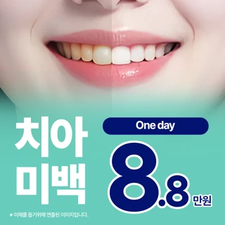 치아미백 - 누런이, 치아변색, 치아착색이 고민이었다면