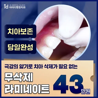 라미네이트 고민끝, 아이디 무삭제 라미네이트
