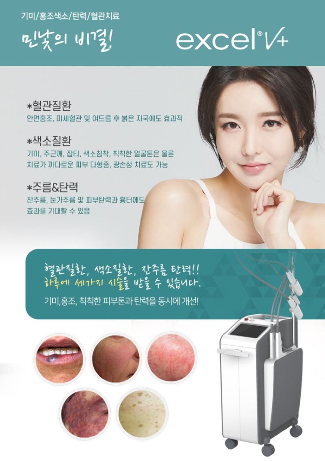 엑셀V 플러스 (Excel V Plus)
시술 원리

엑셀V 플러스는 미국 Cutera(큐테라) 社의 프리미엄 혈관·색소 레이저로,
532nm + 1064nm 이중 파장을 활용해
표피·진피 깊이에 위치한 붉은기, 모세혈관 확장, 색소(기미·잡티)를 선택적으로 타겟팅합니다.
균일한 레이저 에너지가 문제 부위에만 집중되며 주변 피부 손상을 최소화합니다.

효과
홍조·모세혈관 확장·붉은기 완화
기미·잡티·칙칙함 개선
여드름 자국(붉은 흔적) 완화
피부 결·톤 균일도 상승
피부 진정 & 광채 톤업 효과

시술 특징

정교한 냉각 시스템으로 통증 최소화
혈관·색소를 동시에 관리하는 듀얼 파장 장점
피부 타입·고민에 따라 1:1 맞춤 파라미터 설정
다운타임 거의 없어 즉시 일상생활 가능
엑셀V 플러스만의 균일하고 안정적인 조사 에너지

정품 사용 안내 (The Beautiful Clinic)

The Beautiful Clinic은
정품 큐테라 엑셀V 플러스 기기 100% 사용
레이저 팁·모듈 전부 정품 관리 체계 유지
피부 상태 분석 후 정량·정밀 에너지 설정으로
과하거나 부족함 없이 가장 안전한 결과를 만듭니다.

