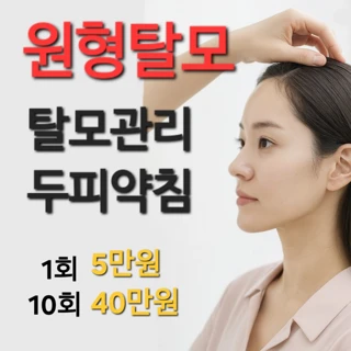 분당 원형탈모관리_두피약침 미주모MIZUMO