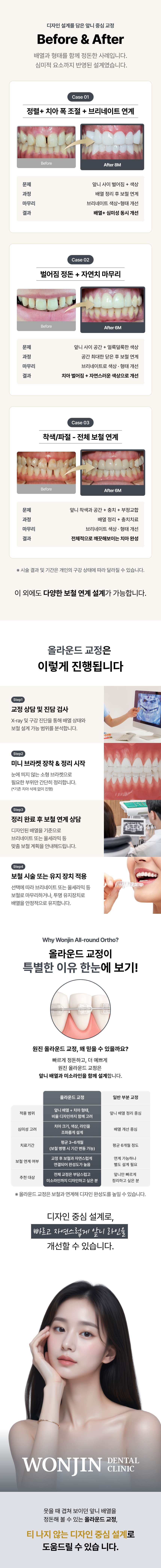 올라운드교정은 건강과 예쁨을 조합하여 최선의 결과를 제공하기 위한 패키지 진료입니다.

전체 진료 과정은 2단계로 구성 됩니다.
1단계: 1개월 이상의 투명교정을 통해 치아의 배열을 건강하게 교정합니다.
2단계: 미용보철을 통해 예쁜 치아 형태와 색상을 완성합니다.