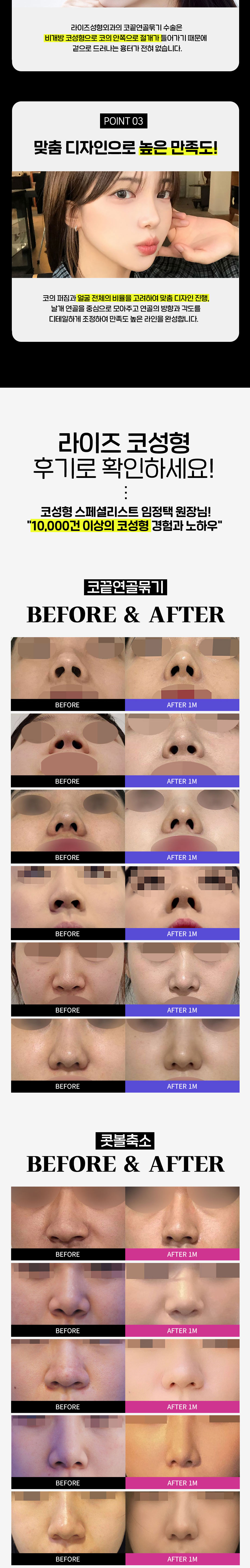 코성형 스페셜리스트 임정택 원장님의 오랜 경험과 노하우로
만족도 높은 결과를 드리겠습니다.

- 정직한 진료
- 안전한 수술
- 프라이빗한 회복실
- 1:1 맞춤상담과 디자인
- 사후관리 풀패키지 포함 (추가비용 없음)
- 콧볼축소 : 수술시간 20분 내외 
- 코끝연골묶기 : 수술시간 30분 내외 
