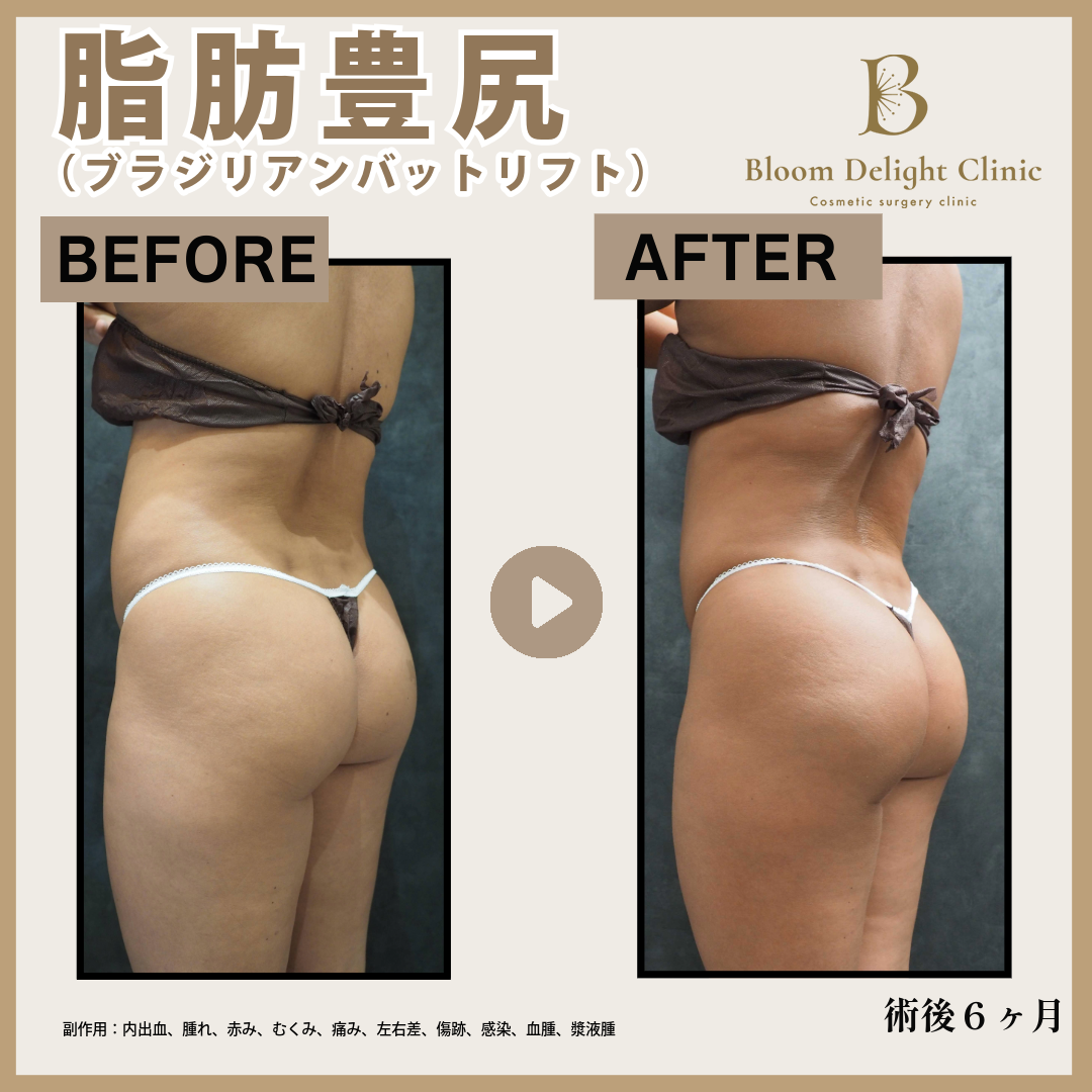 尻」の口コミ・情報・価格 28件を比較【2026年最新】|Unni（カンナム