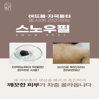 여드름 색소침착 자국제거 모공각화증 닭살피부 스노우미세약초침 1회 체험가