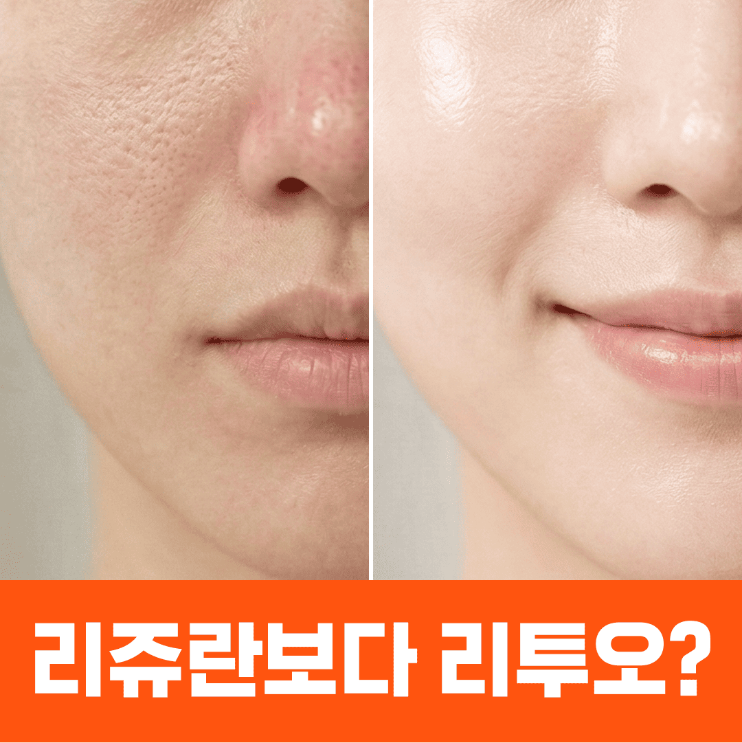 스킨부스터 끝판왕, 리쥬란보다 리투오? 효과·가격·부작용 어때