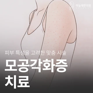 모공각화증 치료-닭살피부