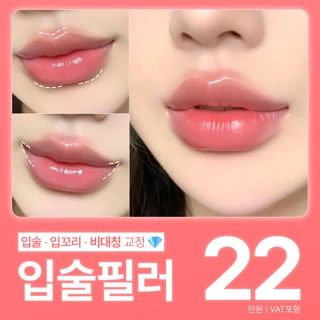 입술 입꼬리 전체필러 자연스럽게 시술 몬스터의원