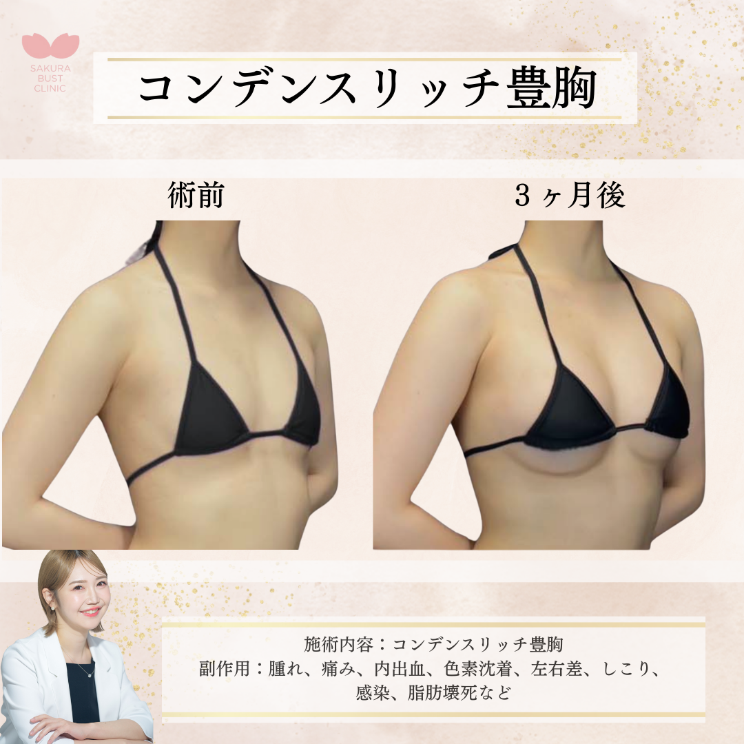 東京都 バストアップ+豊胸 おすすめクリニック・値段の比較(2026