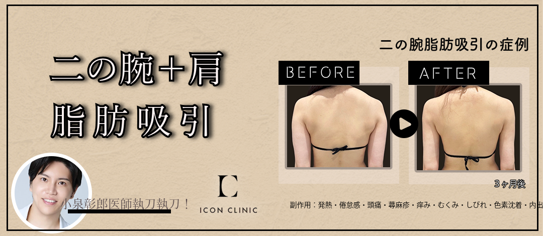 小泉医師執刀｜脂肪吸引｜二の腕＋肩 | ICON CLINIC【アイコンクリニック】
