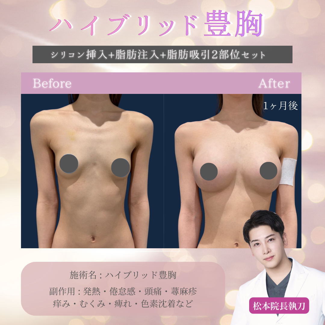 渋谷 胸(保形物 脂肪移植) おすすめクリニック・値段の比較(2026