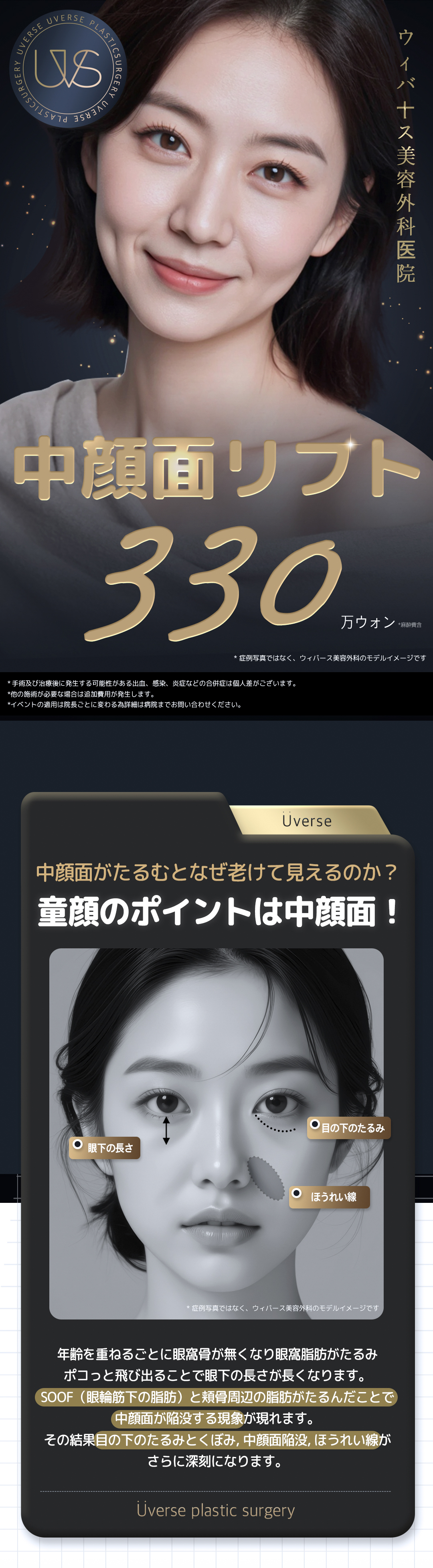 中顔面リフト | ウィバース美容外科医院