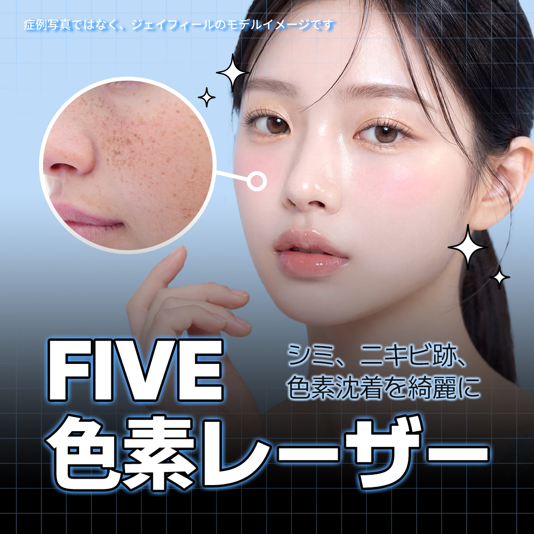 色素の悩みにFIVEレーザー | Jfeel医院 江南院