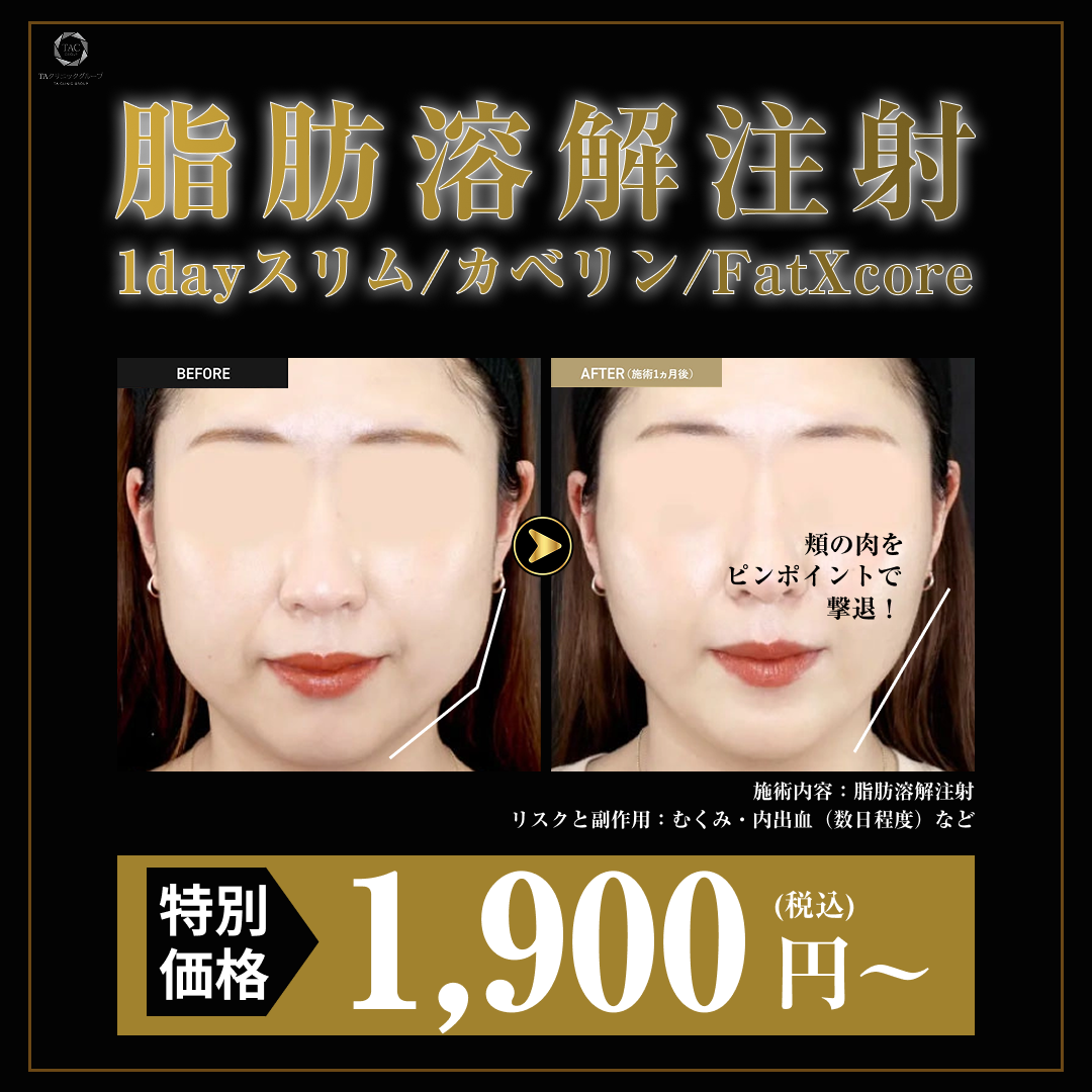 銀座・新橋・有楽町 脂肪溶解注 安い順 おすすめクリニック・値段の