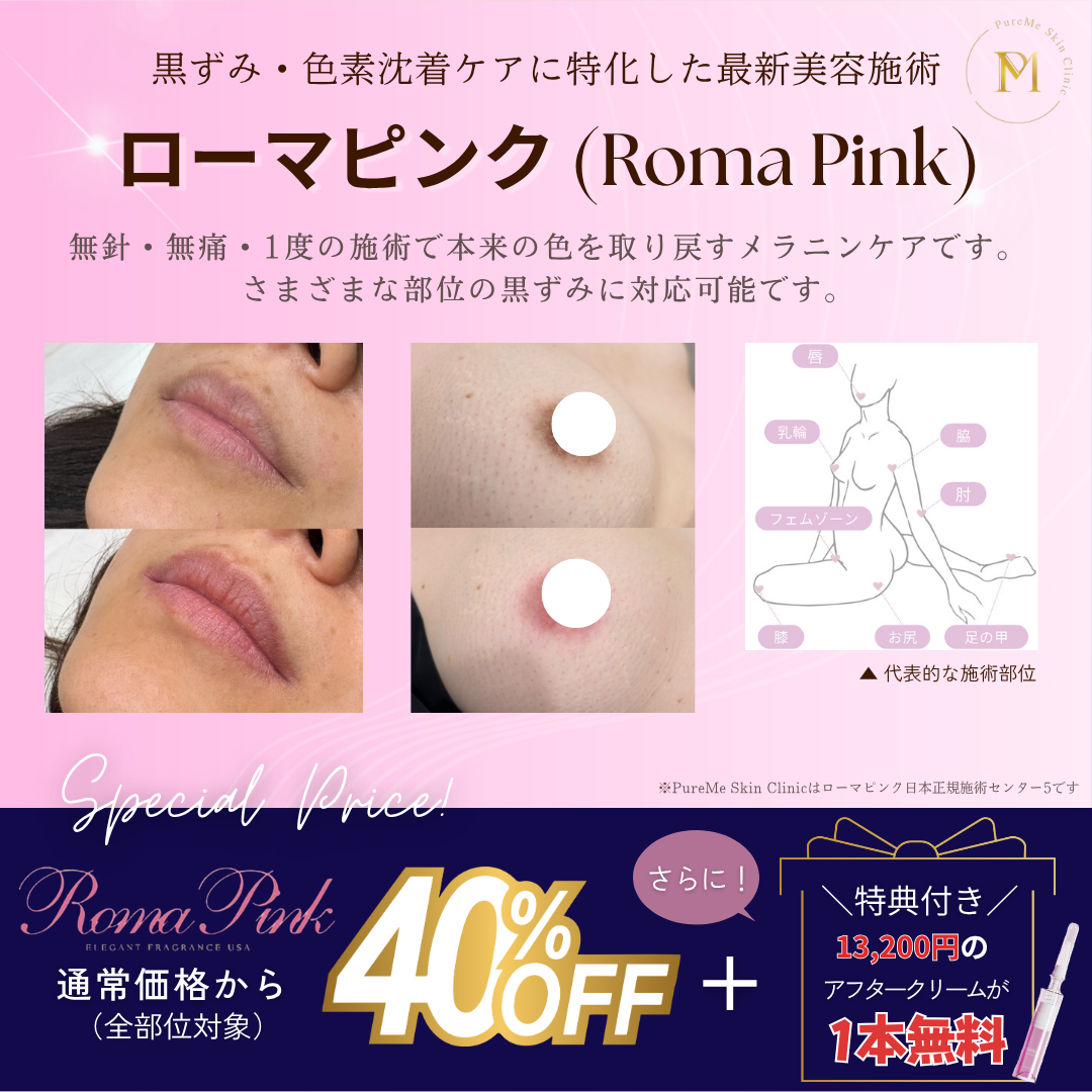 ローマピンク（Roma Pink）｜唇などのお顔～デリケートゾーン｜黒ずみ