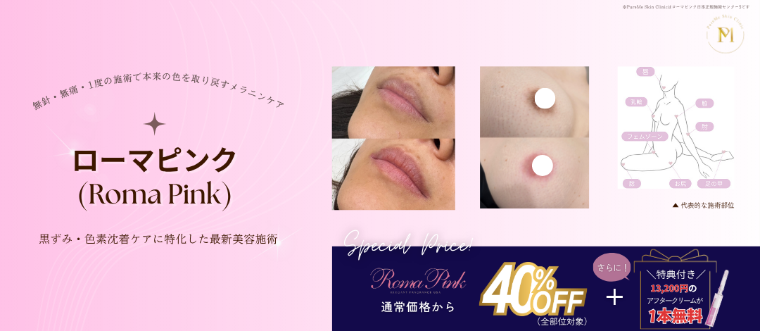 ローマピンク（Roma Pink）｜唇などのお顔～デリケートゾーン｜黒ずみ