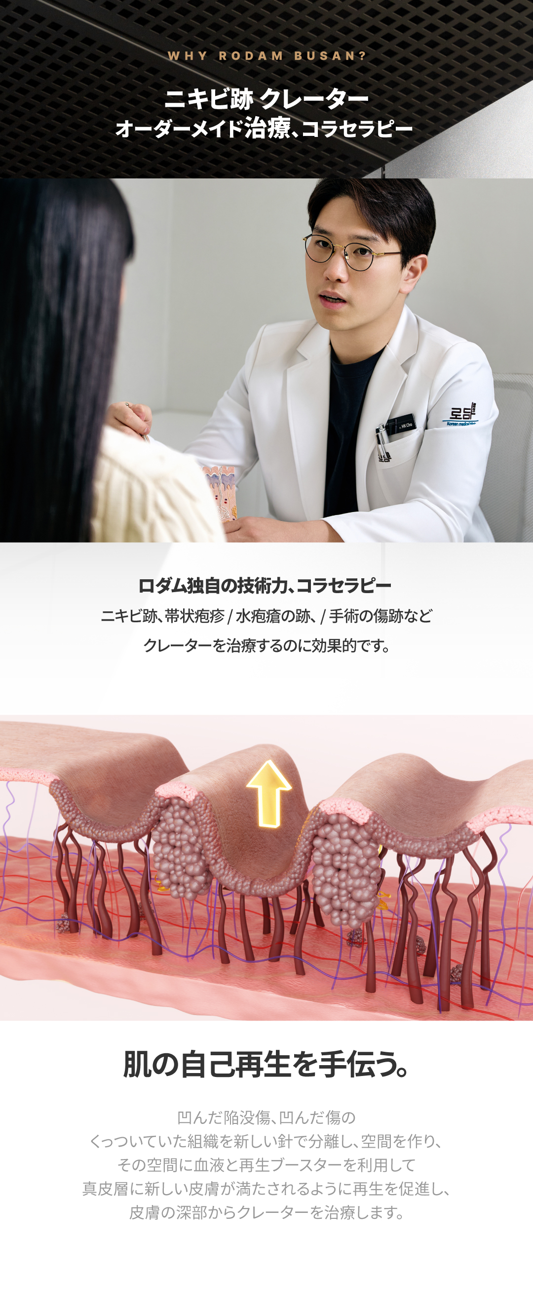 傷跡の治療、にきび治療に非常に効果的なアプリケーション ニキビ跡、水痘傷跡などのへこみ傷跡の治療、初診コラセラピーイベント