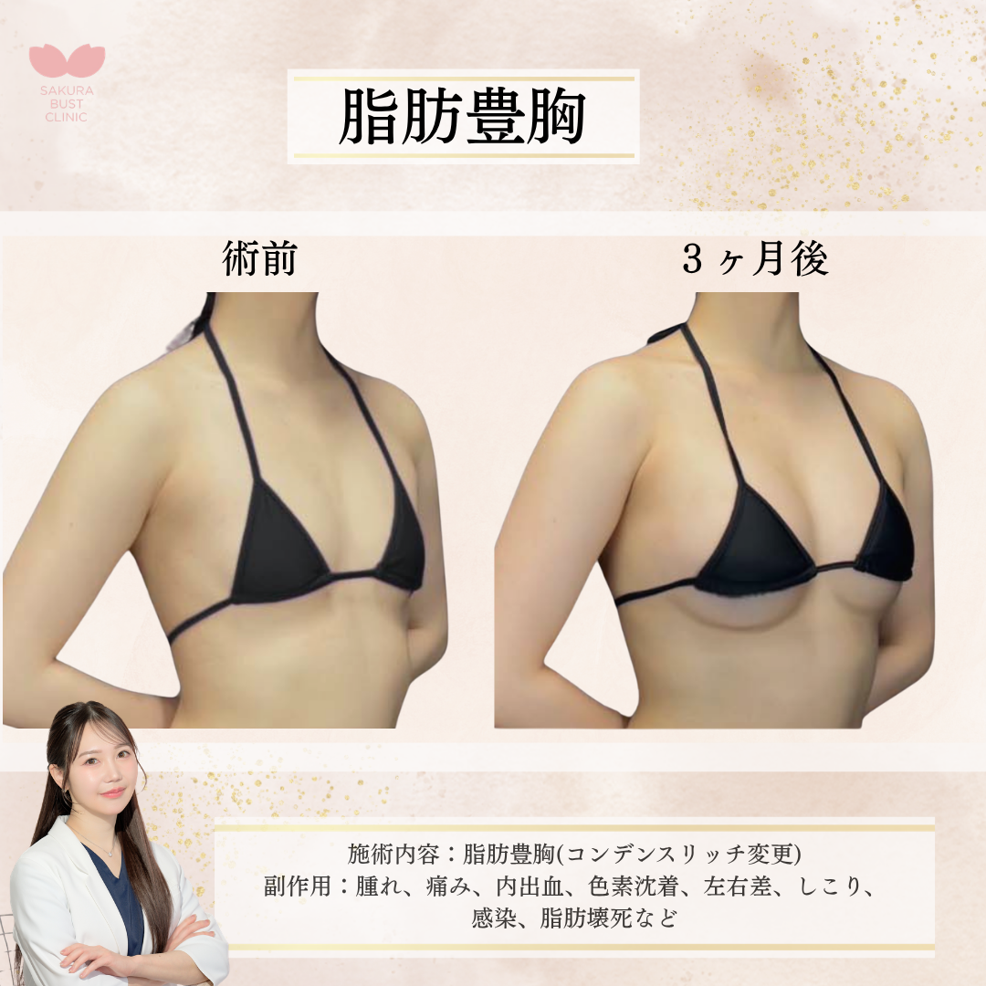 豊胸 おすすめクリニック・値段の比較(2026) | カンナムオンニ