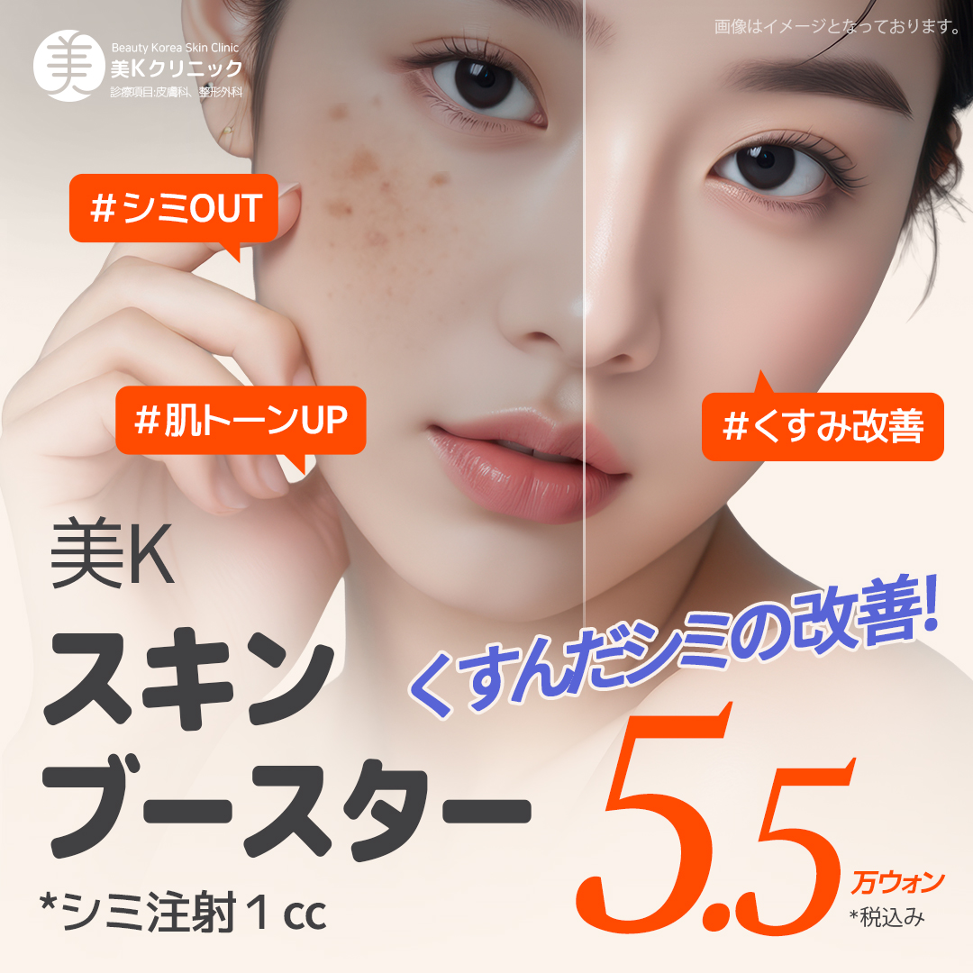 リジュランスキンブースター おすすめクリニック・値段の比較(2026