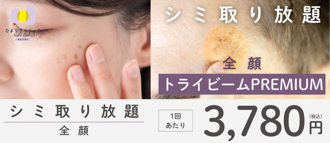 シミ取り放題 | ひよりクリニック心斎橋院 ( 旧メディカルエピ 