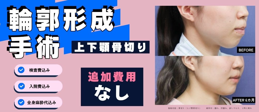 モニター】全身麻酔・入院費・検査費全て込み｜上下顎セットバック 