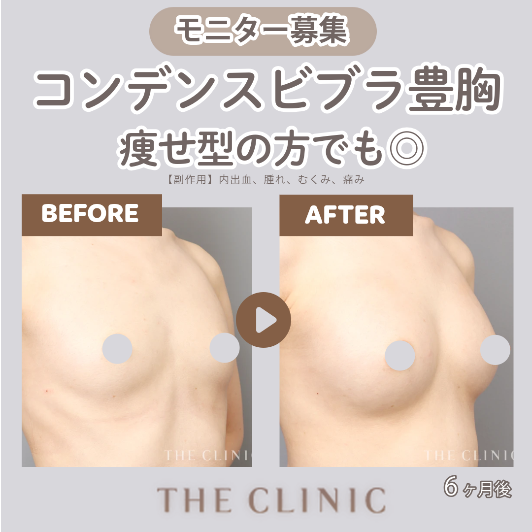 六本木・麻布十番 バストアップ+豊胸 新着順 おすすめクリニック・値段