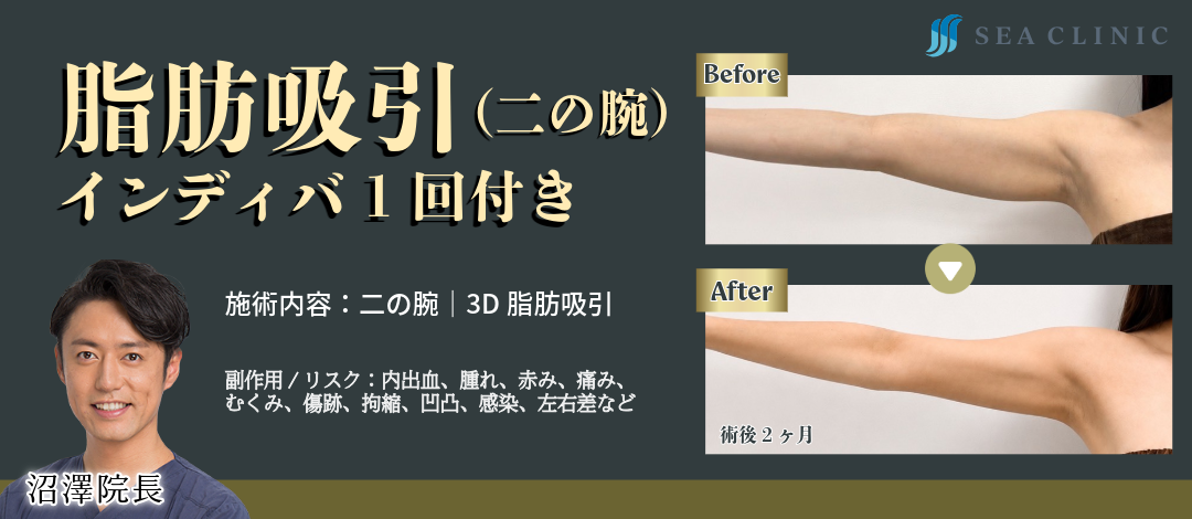 理事長執刀】脂肪吸引（二の腕）｜インディバ1回付き｜3D吸引で二の腕