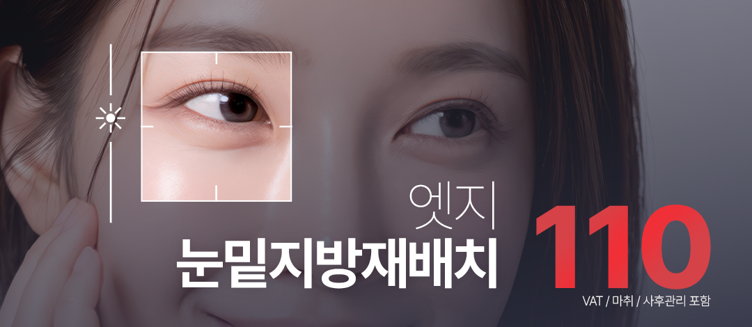 엣지성형외과의원 대구 엣지 눈성형_눈밑지방재배치 이벤트 이미지