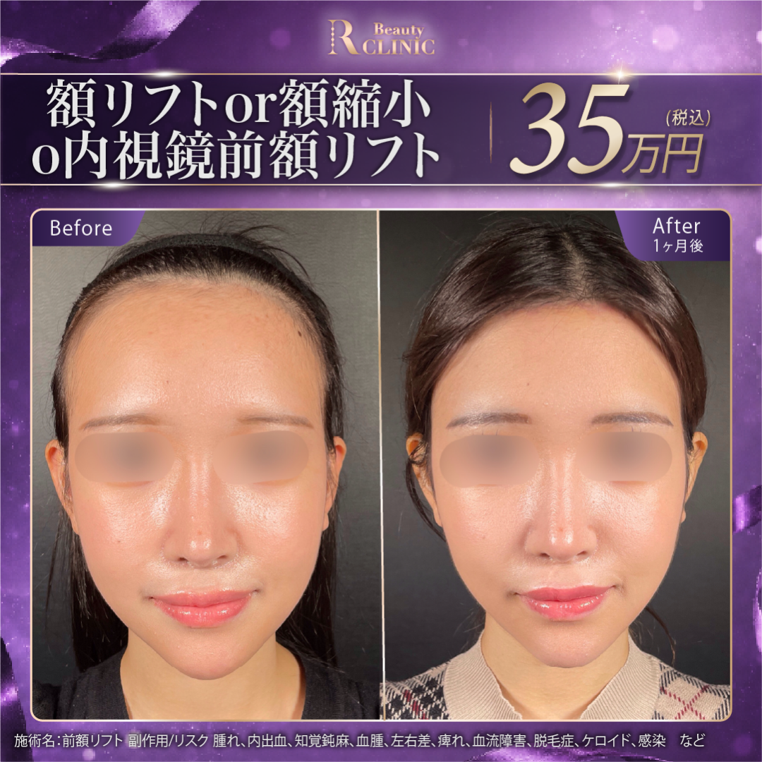 顔面」の口コミ・情報・価格 469件を比較【2026年最新】|Unni