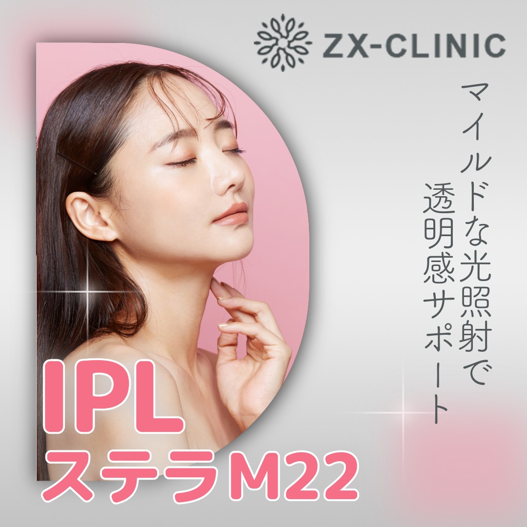 GSD フォトフェイシャル 何度でも可】IPL（光治療）全顔2周 ｜ステラM22フォトフェイシャル