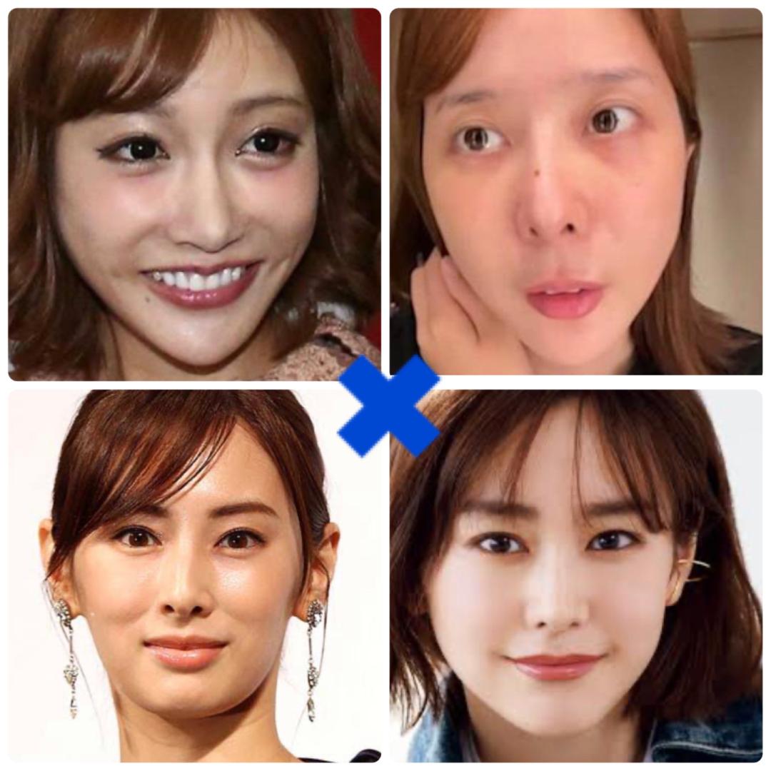 クリニックQ&A: 輪郭3点、鼻フルを考... | 日本最大級の美容医療・整形  