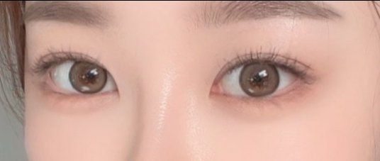 クリニックQ&A: 華やかな大きな目が欲... | 韓国No.1美容医療アプリ