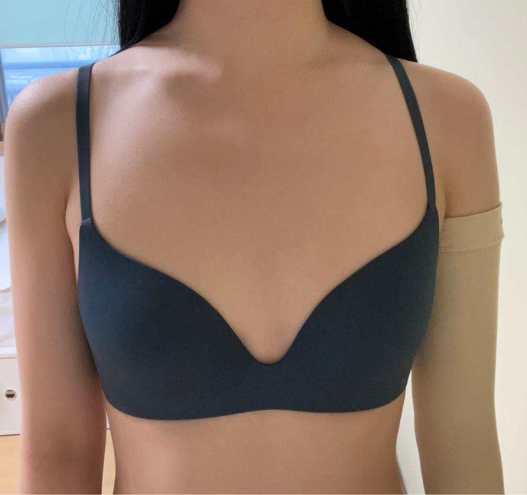 자유수다: 가슴 멘토스무스 2... | 강남언니 - 1등 성형수술&피부시술 정보앱