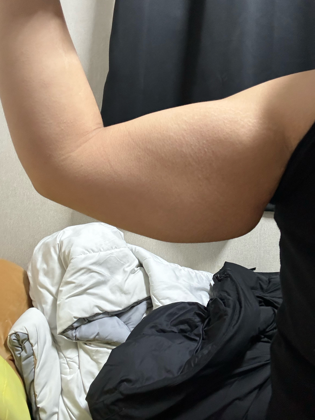 자유수다: 안녕하세욤 ㅎㅎ ... | 강남언니 - 1등 성형수술&피부시술 정보앱