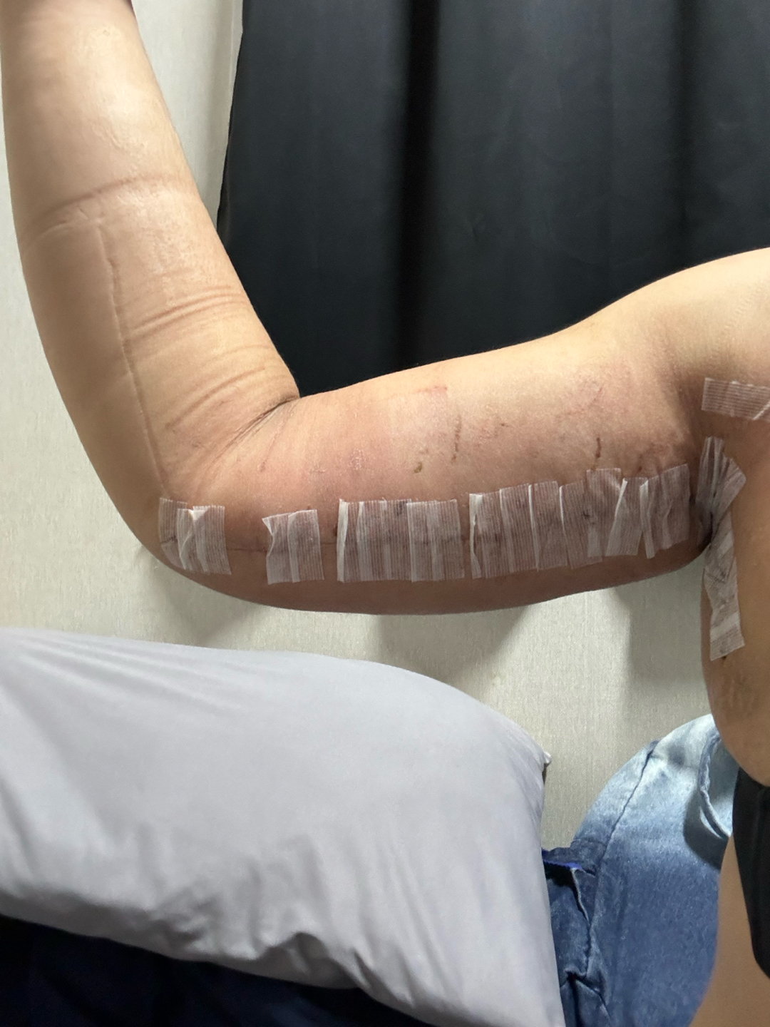 자유수다: 안녕하세욤 ㅎㅎ ... | 강남언니 - 1등 성형수술&피부시술 정보앱