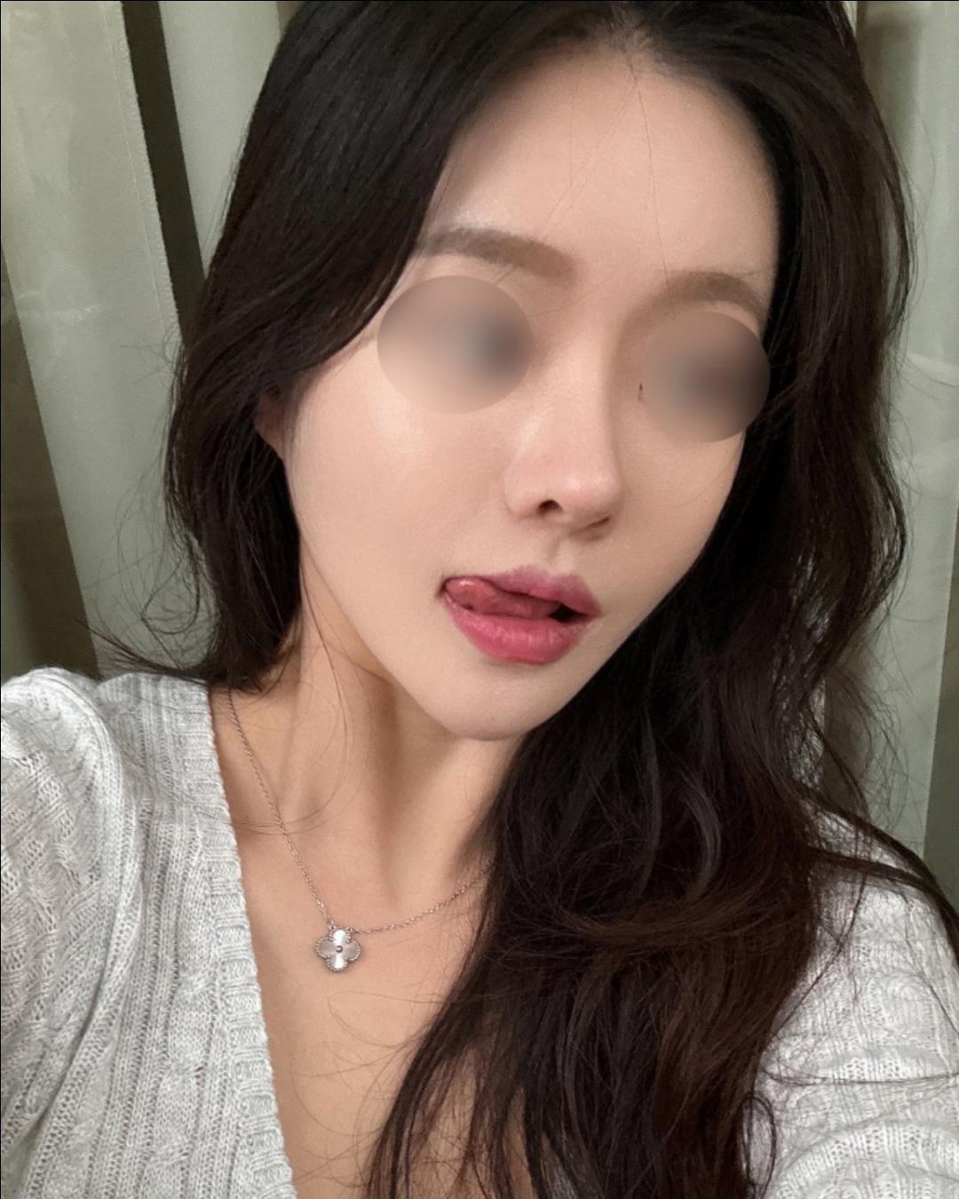 자유수다: 원래 엄청 작은코인... | 강남언니 - 1등 성형수술&피부시술 정보앱