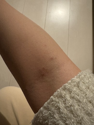 after photo: 美容注射・点滴