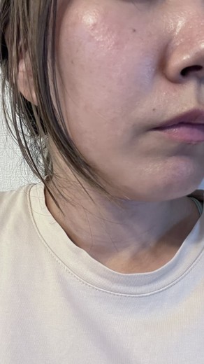 before photo: ジュベルック(Juvelook)