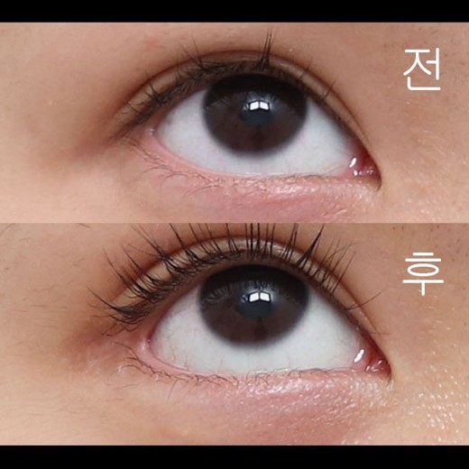 after photo: 밑트임, 뒤트임