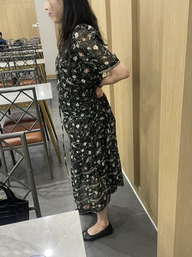 before photo: 허벅지지방분해주사