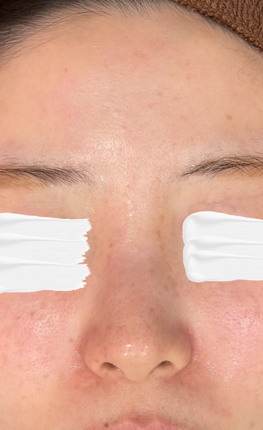 再来OK】ハイドラフェイシャル＋エレクトロポレーション | おおかみ