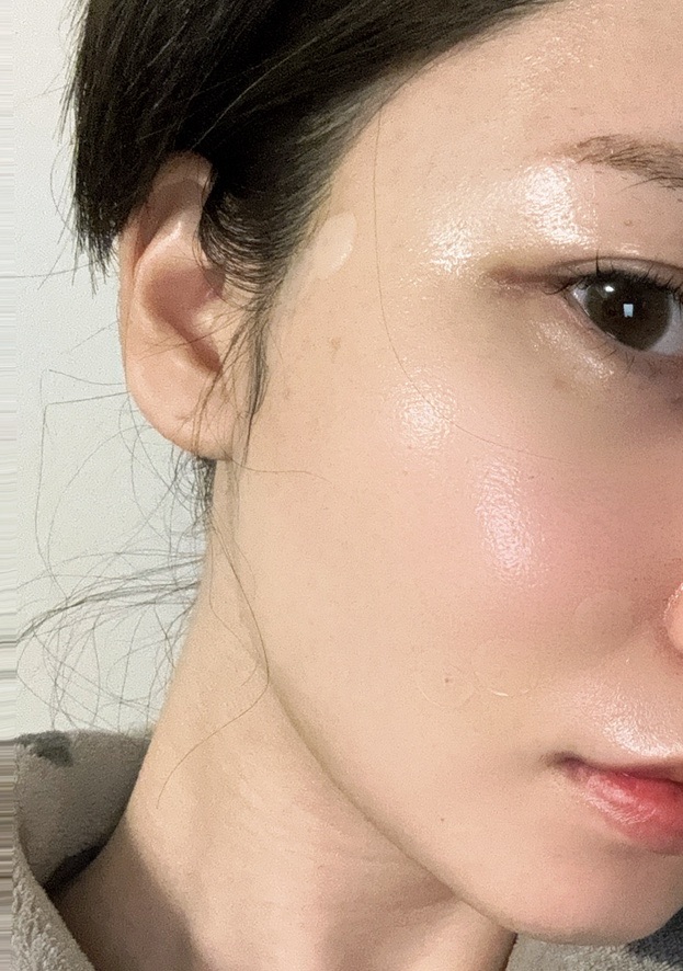 ララドクター＋エレクトロポレーション（全顔＋首・1回）【再来OK