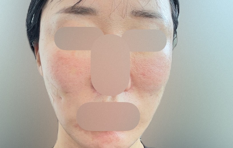 after photo: 엘라비에리투오