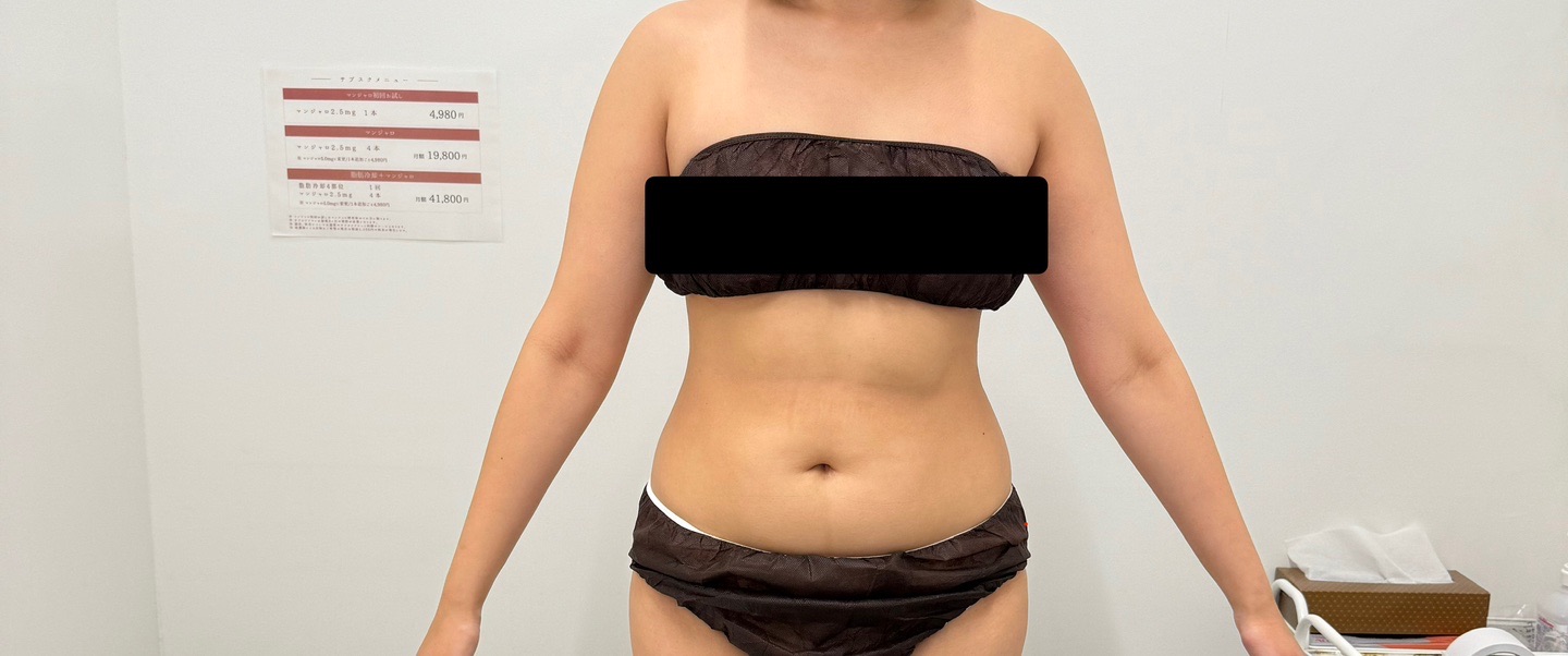 スノエル（脂肪冷却）2パーツ4ハンドル 部分痩せしたい方◎ | オルタ