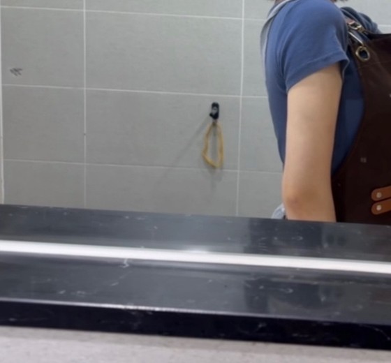 after photo: 팔지방흡입, 부유방흡입