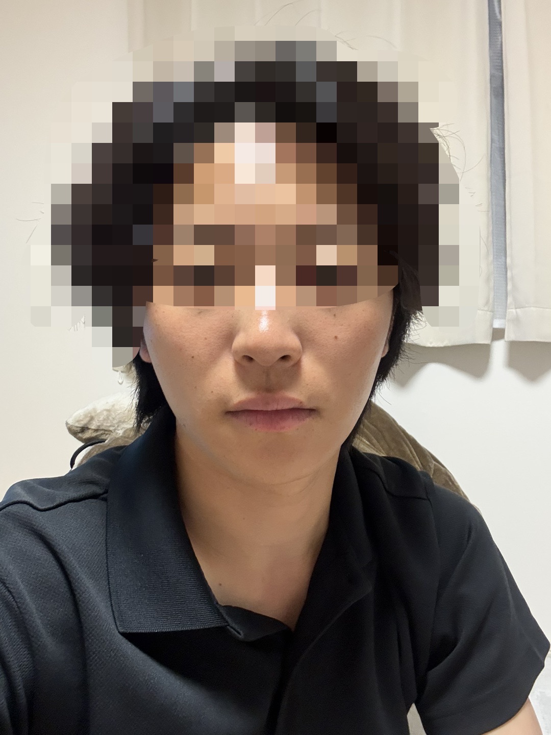 何度でも可】【男性限定】顔全体脱毛（髭全体＋鼻＋額）ジェントル