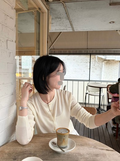 after photo: 턱끝필러