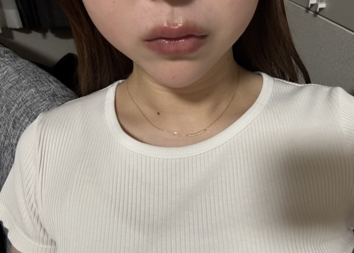 before photo: リニアファーム(ハイフ)