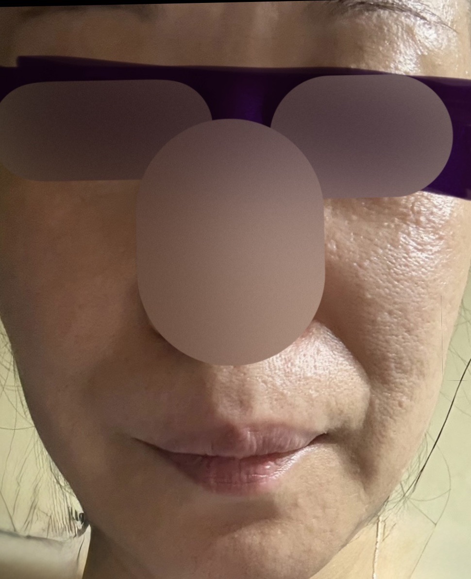 10月15日迄のご予約で初診料0円】ポテンツァ ダイヤモンド