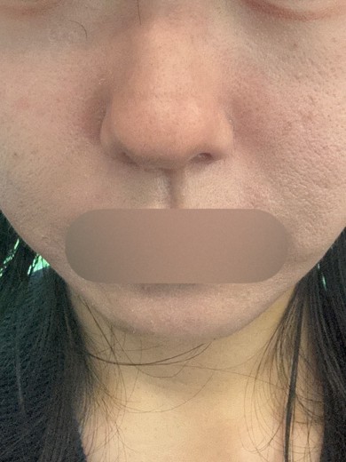 after photo: ルメッカ